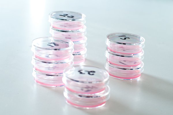 Petri Dishes