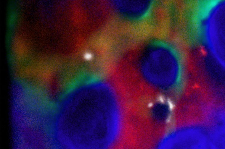 New research reveals potential replacement for chemotherapy or radiation for leukaemia and other blood disorder patients pre-transplant